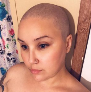 Permanently Bald and Chelsea's Mother